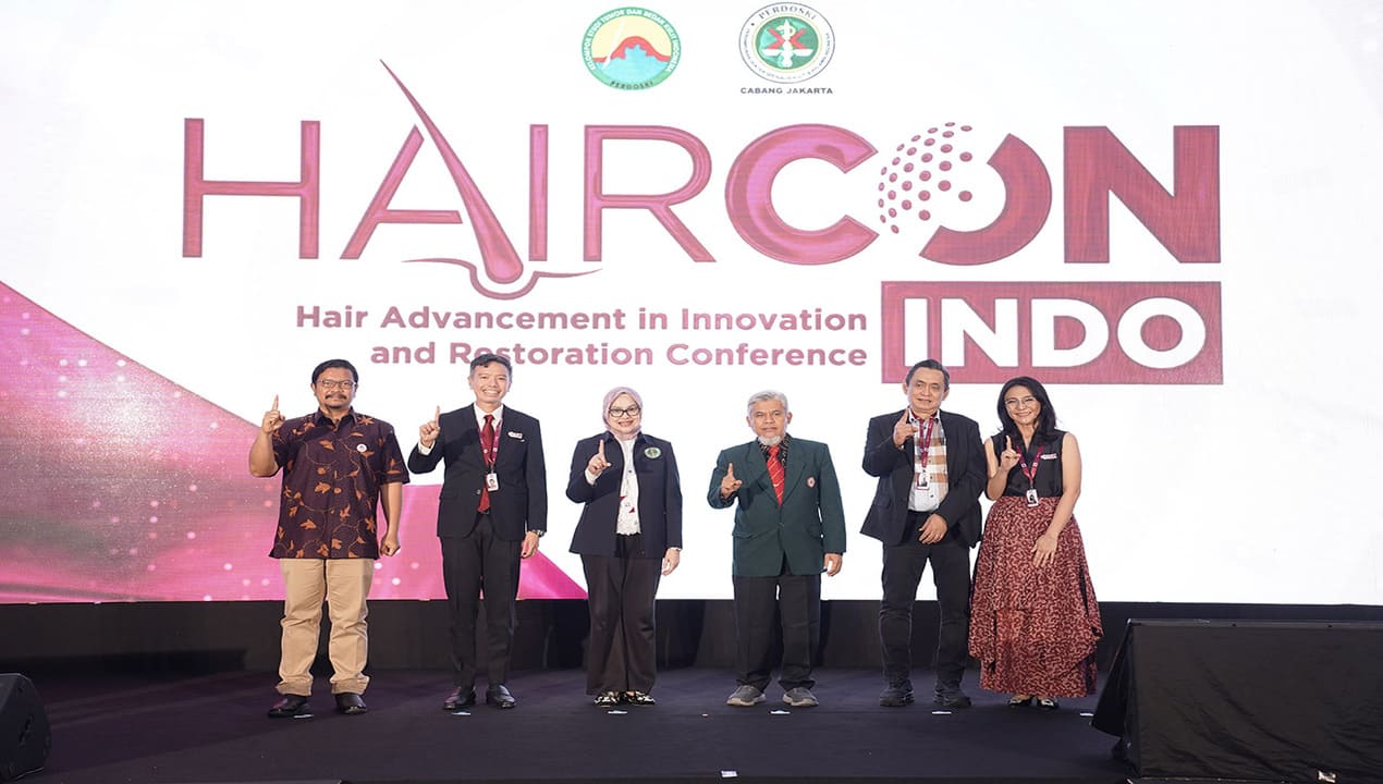 Inovasi Terbaru Terapi dan Transplantasi Rambut di HAIRCON